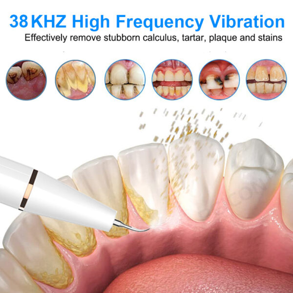 Ultrasonic Dental Scaler For Teeth Tartar Stain Tooth Calculus Remover Electric Sonic Teeth Plaque Cleaner Dental Stone Removal 2